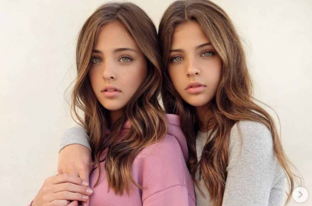 Ava y Leah, las gemelas «más hermosas» del mundo ya crecieron y así lucen ahora 2