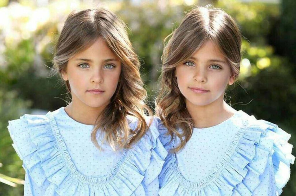 Ava y Leah, las gemelas «más hermosas» del mundo ya crecieron y así lucen ahora 0