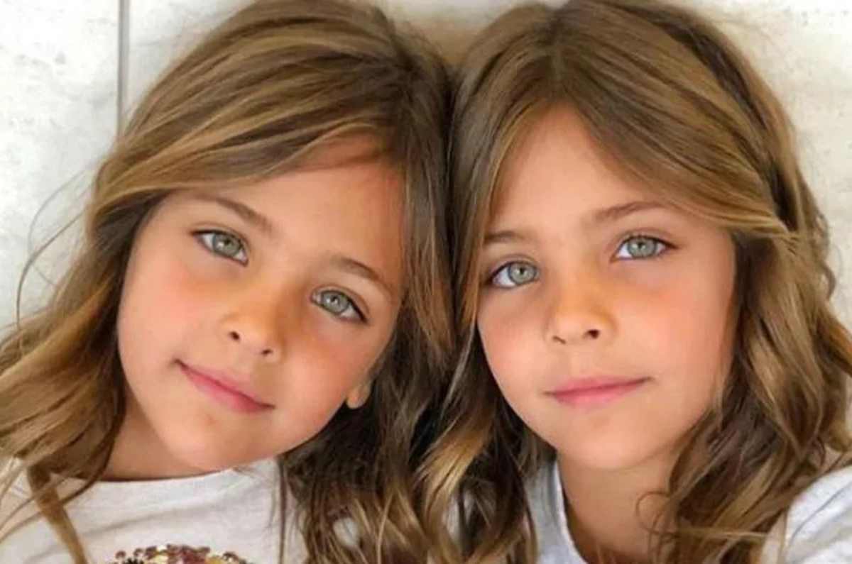 Ava y Leah, las gemelas «más hermosas» del mundo ya crecieron y así lucen ahora
