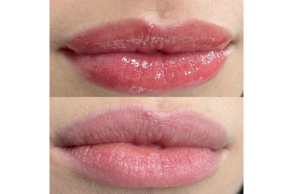 5 remedios caseros para curar los labios resecos en primavera 0