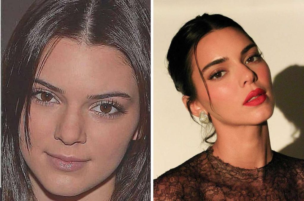 Kendall Jenner cambios físicos