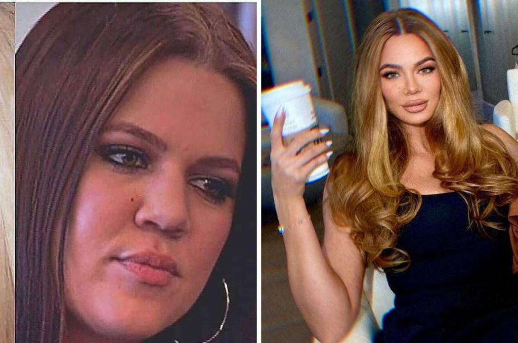 Khloé Kardashian cambios fisicos