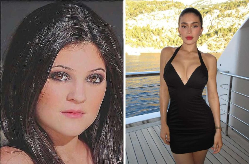Kylie Jenner cambios físicos
