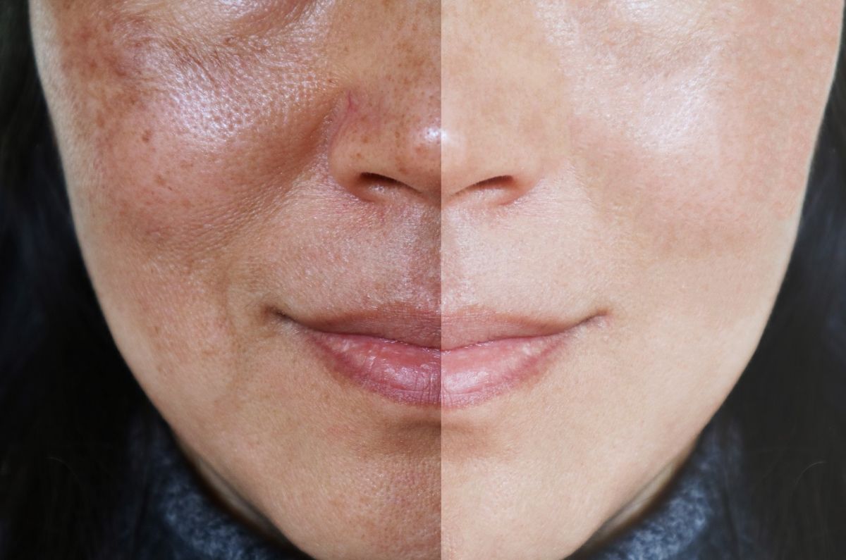 Top de cremas aclarantes para rostro en menos de $150.00