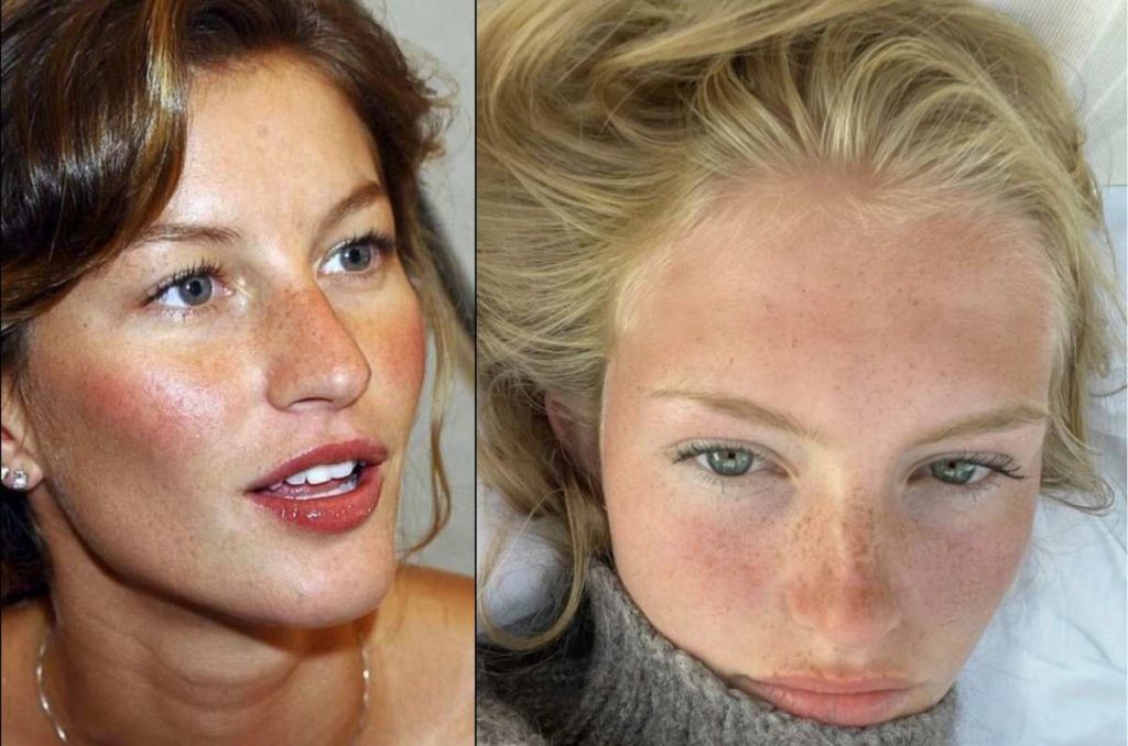 qué es el maquillaje “wind burn”