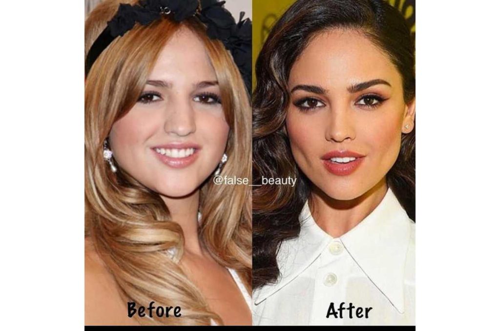 Eiza González: Este fue el cambio estético más drástico en su rostro 2