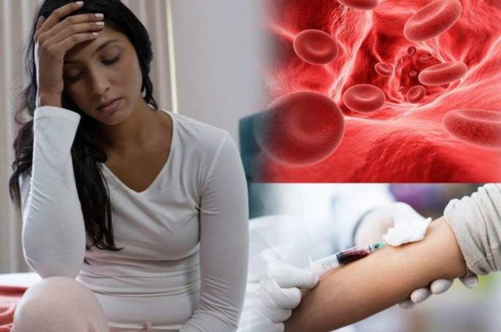 Anemia