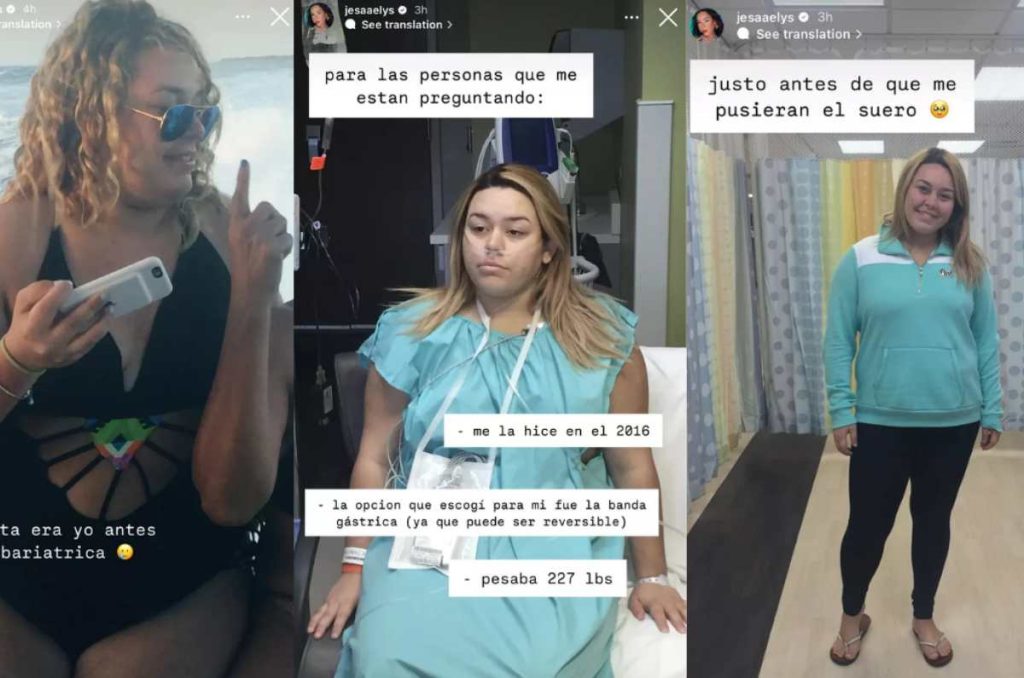 cirugía bariátrica hija daddy yankee
