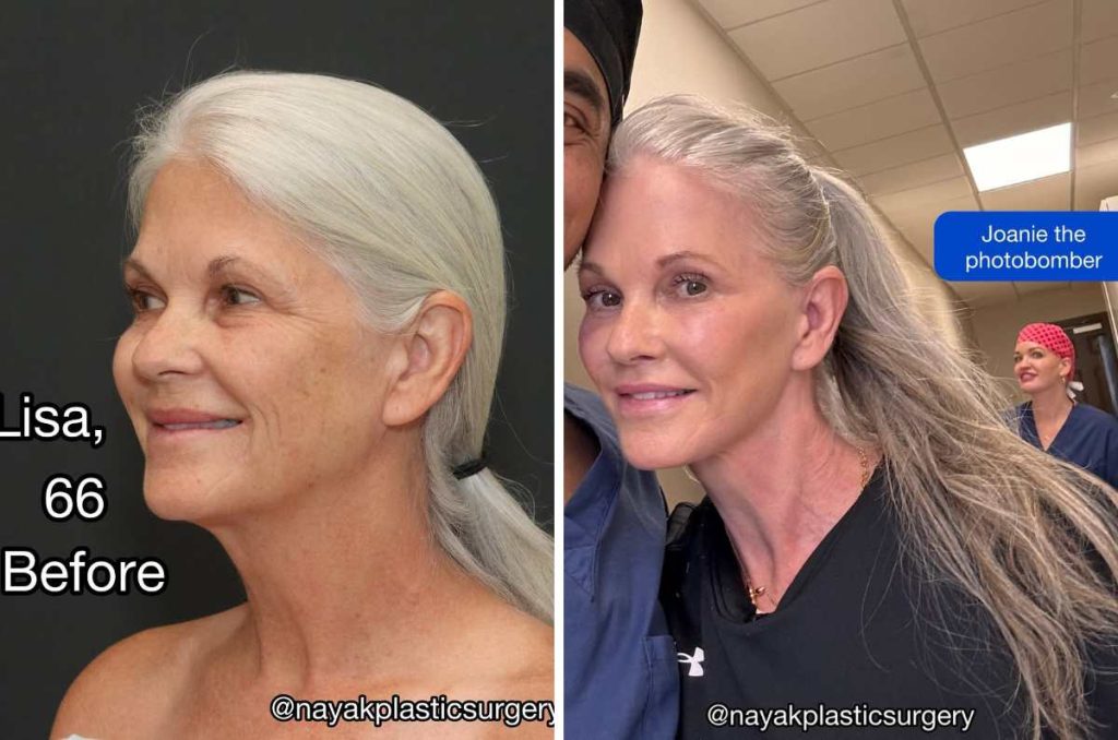 antes y después de la operación