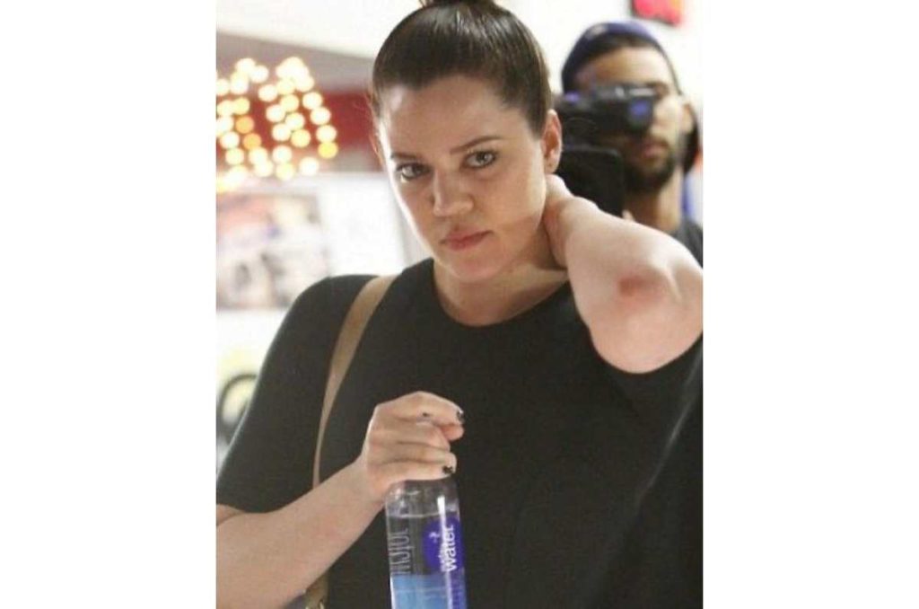 Khloé Kardashian antes