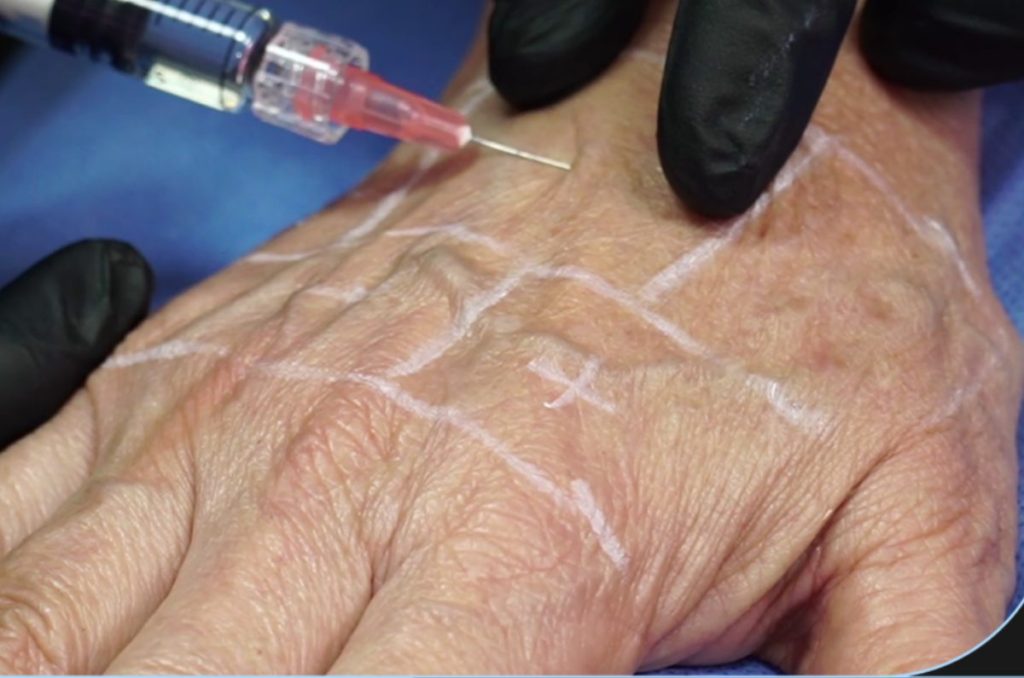 cirugia-sin-bisturi-tratamientos-esteticos