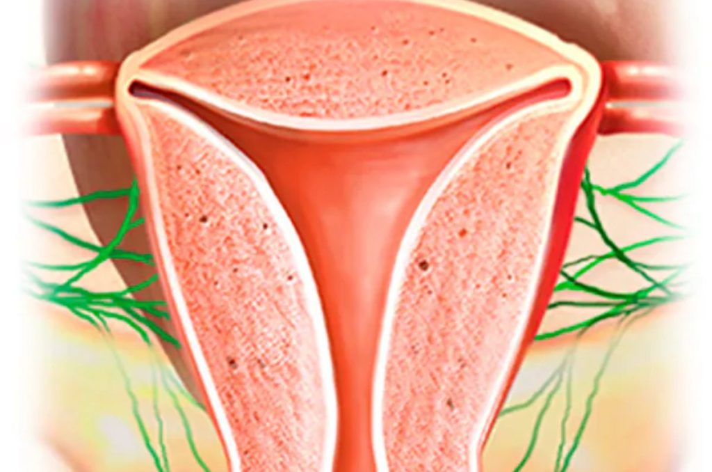 cancer-cervicouterino-sintomas-que-es