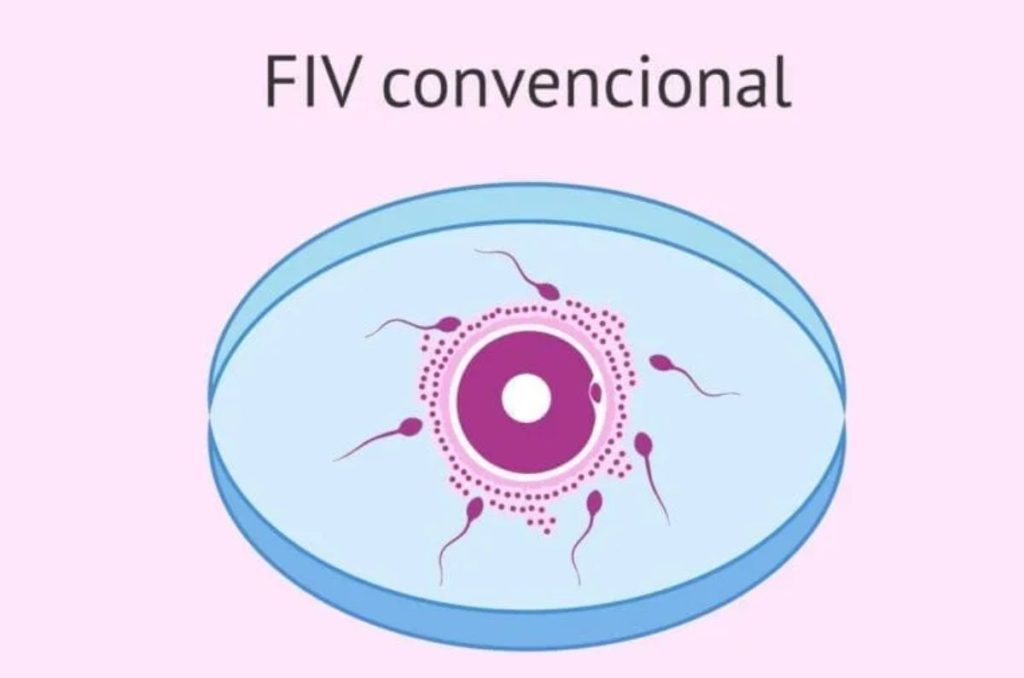 fecundacion-in-vitro-3