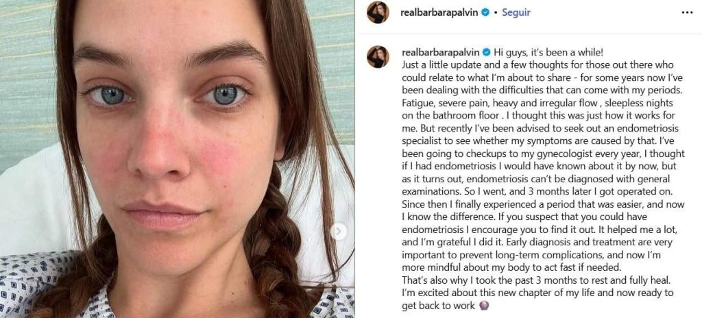 Bárbara Palvin padece endometrios