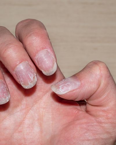 ¿Por qué se quiebran las uñas? Haz que luzcan hermosas