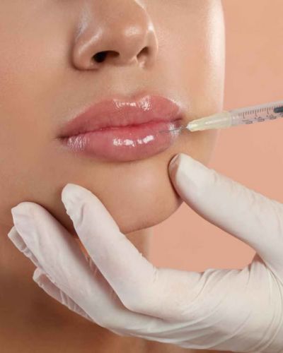 Ácido hialurónico en los labios
