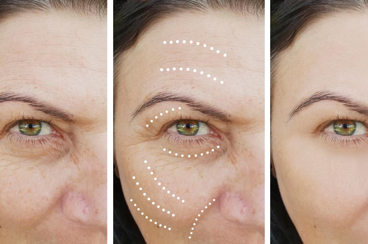 Medicina regenerativa: el secreto para lograr un rejuvenecimiento facial de alto impacto