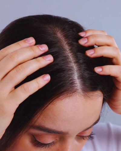 Cuero cabelludo irritado