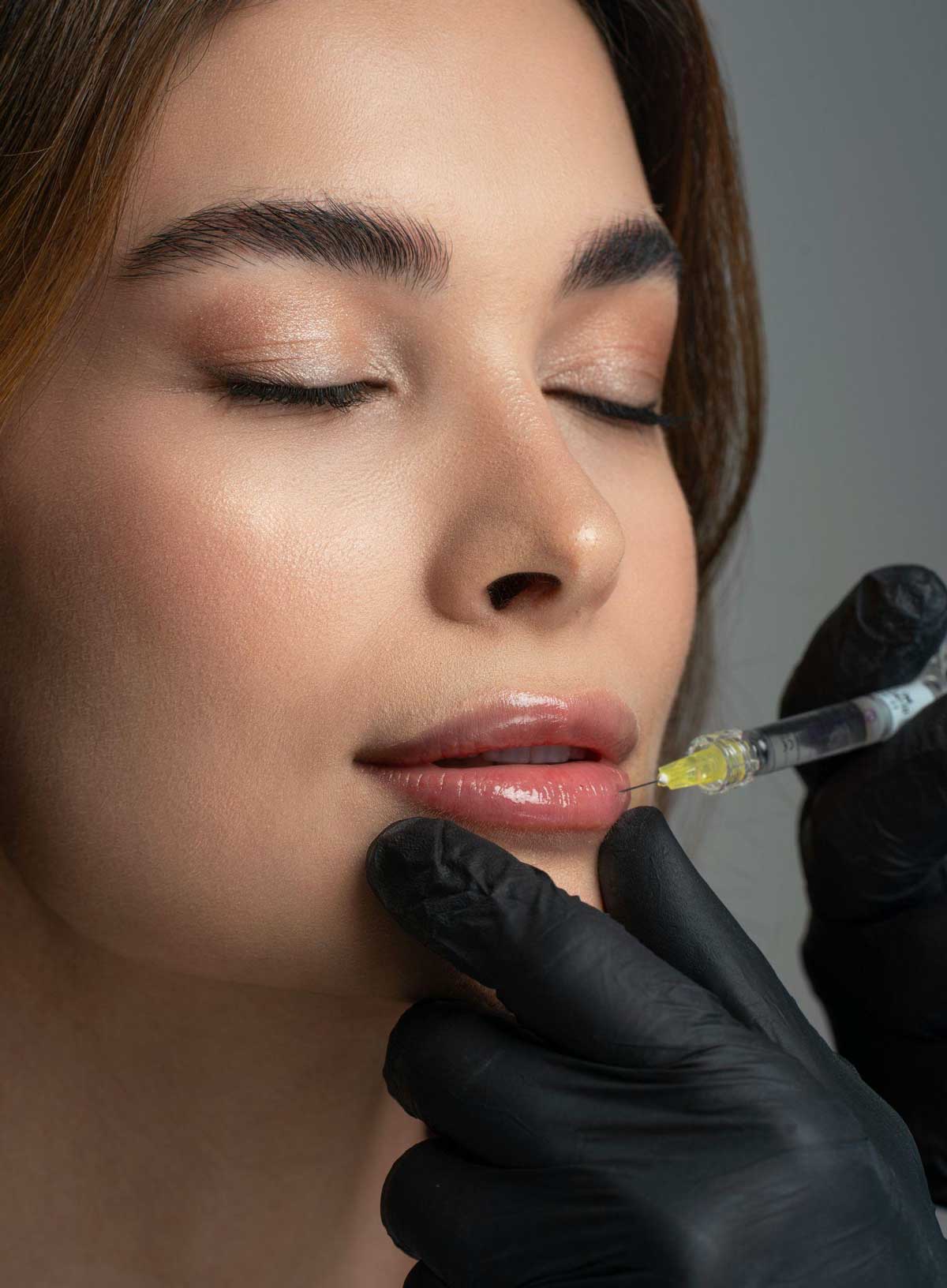 Aumento de labios sin cirugía: qué esperar y cómo prepararte para un cambio sutil y natural