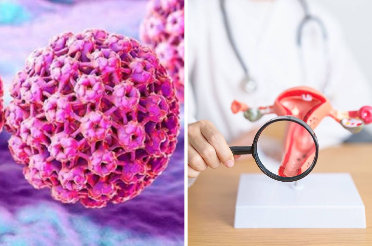 VPH entre las principales causas del cáncer cervicouterino