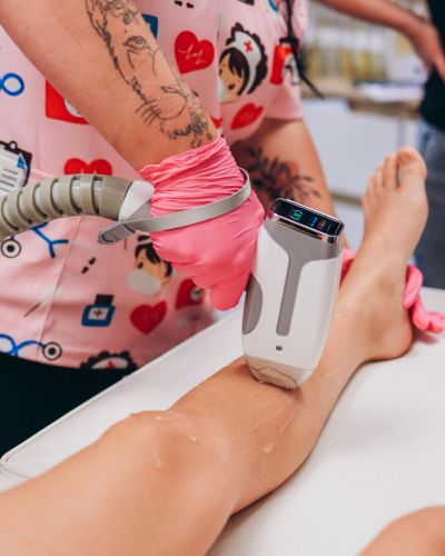 Tratamiento de depilación láser en piernas para reducir vellos enterrados y prevenir irritación.