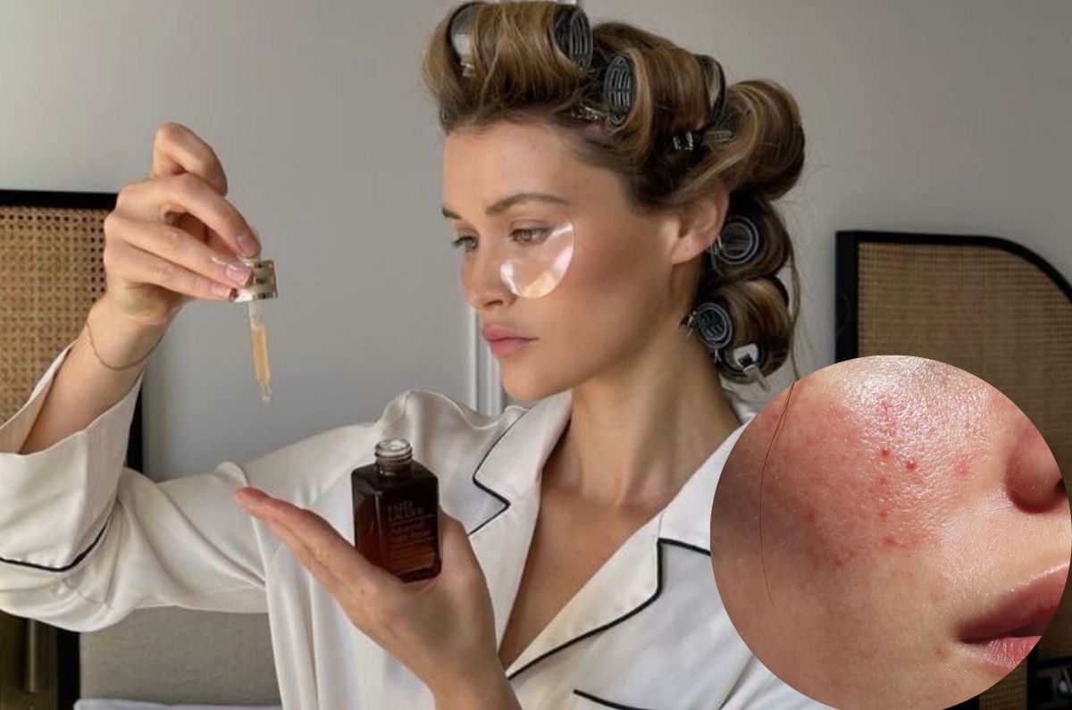 Productos de skincare que no debes combinar si quieres una piel sana