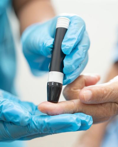 Manos con guantes realizan una prueba de glucosa con lanceta en la yema del dedo.