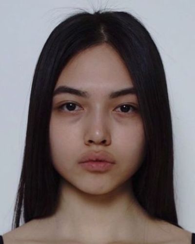 El color de tus ojeras y lo que revela sobre tu salud