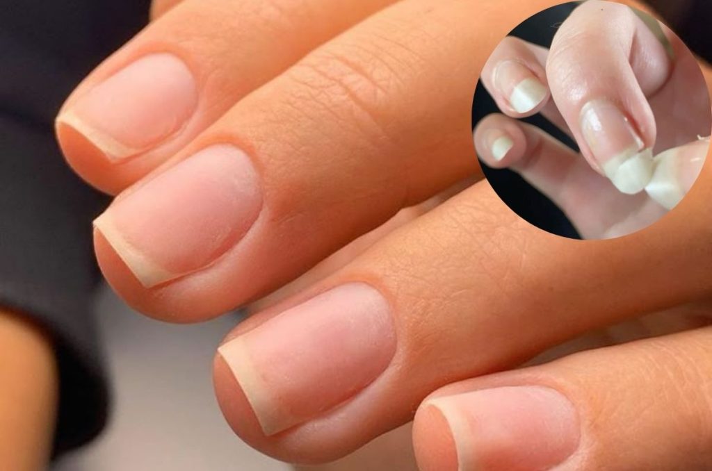 Lo que dicen tus uñas de tu salud