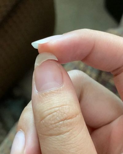 Lo que dicen tus uñas de tu salud